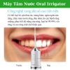 Máy tăm nước Oral Irrigator Pro 2.024 - 3 cấp độ, 4 đầu tăm, giảm giá 209.000₫ 9