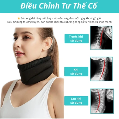 Nẹp Cổ SOFTURE SNC01 - Giảm Cổ Rùa, Định Hình Cổ, Đau Vai Gáy, Đai Hỗ Trợ 150k 3