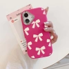 Ốp lưng iPhone Nơ trắng TPU – Chống sốc, tương thích iPhone 16‑15‑14‑13‑12‑11 Pro/Promax/7/8 Plus/X/XR/XS Max/SE – Giá 26.900₫ 9