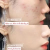 Phấn Nước Cushion MOI Premium Holiday Cosmetics Hồ Ngọc Hà - Giảm 20% chỉ 399.000đ 6