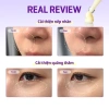 SOME BY MI Kem mắt Retinol 0.1% Action 30ml Dưỡng sáng, giảm nếp nhăn, giá 411.840₫ 5