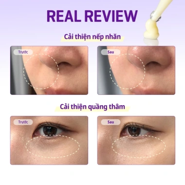 SOME BY MI Kem mắt Retinol 0.1% Action 30ml Dưỡng sáng, giảm nếp nhăn, giá 411.840₫