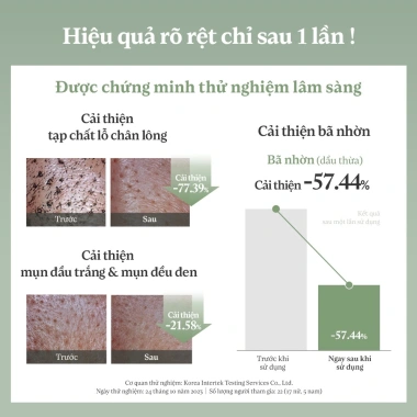 Sữa rửa mặt kiêm mặt nạ đất sét cà chua xanh 2 trong 1 120ml - khít lỗ chân lông, kiềm dầu, giảm 77% bụi bẩn - 319k