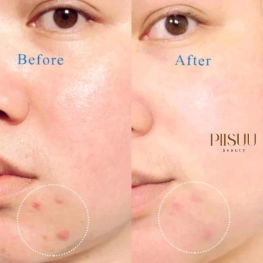 Sữa Rửa Mặt La Roche-Posay Effaclar Purifying Foaming Gel 400ml Giảm nhờn sạch mụn giá 199k 4