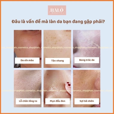 Sữa rửa mặt trắng da, mờ thâm nám, dưỡng da, xoá nhăn, da căng bóng, sáng mịn, chống lão hoá Giá chỉ 89.000