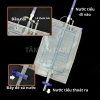Túi Đựng Nước Tiểu Van Chữ T 1.000ml-2.000ml - Tiện Lợi, An Toàn, Tái Sử Dụng, 25.000₫ 5