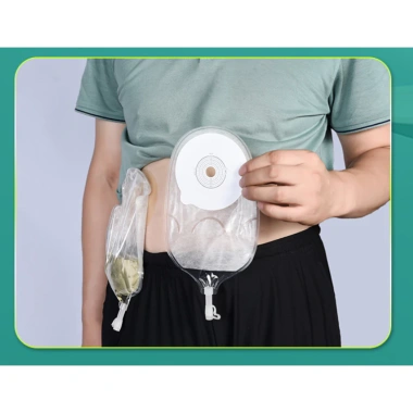 Túi Nước Tiểu Nhân Tạo 1 Mảnh Colostomy Bag Giá Ưu Đãi 43.000₫ - Chất Lượng Cao