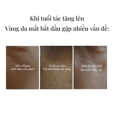 +WIS+ Mặt Nạ Dưỡng Mắt Collagen 7 Chiết Xuất Thực Vật - Dưỡng ẩm, Sáng Da, Giảm Bọng Mắt, Giá Ưu Đãi 250.000₫