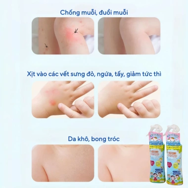 Xịt Chống Muỗi PMY 200ml cho Bé từ 3 tháng – Bảo vệ da trực tiếp, không kích ứng, 59.000₫