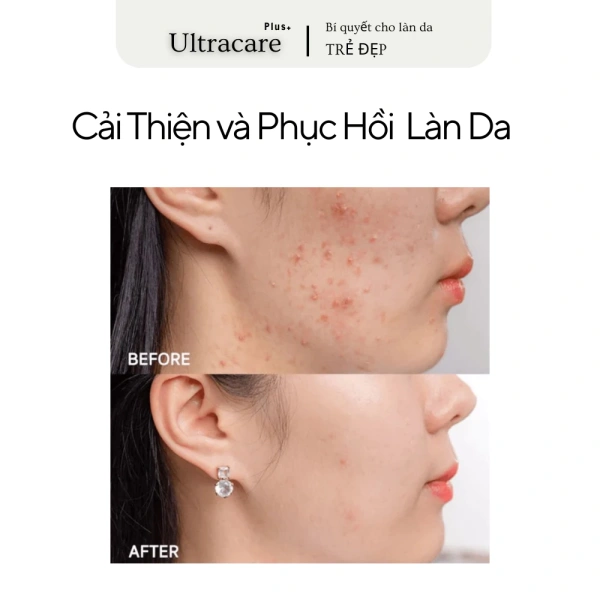 Để hiểu rõ hơn về nguyên nhân lỗ chân lông mở rộng, ta có thể chia các yếu tố ảnh hưởng thành hai nhóm chính: nội tại và ngoại tại. (Ảnh 3)