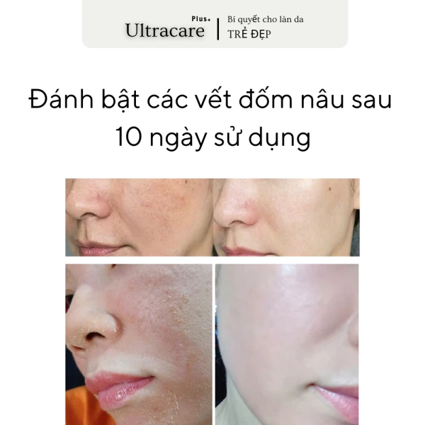 Khi lựa chọn kem tái tạo da, người tiêu dùng thường gặp phải ba loại thành phần chính: sâm (đặc biệt là nhân sâm), peptide, và chiết xuất thực vật thông thường như trà xanh, nha đam. (Ảnh 4)
