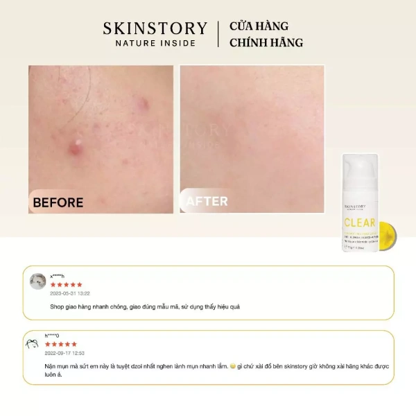 Không chỉ dừng lại ở việc chọn kem, việc xây dựng một quy trình chăm sóc da toàn diện là yếu tố quan trọng để duy trì độ ẩm và hạn chế mụn. (Ảnh 5)