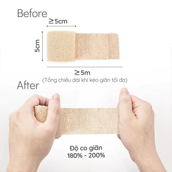 Thực hiện các bước trên sẽ giúp duy trì độ bám dính, giảm nguy cơ da căng rách và kéo dài thời gian sử dụng của băng keo. (Ảnh 5) Thực hiện các bước trên sẽ giúp duy trì độ bám dính, giảm nguy cơ da căng rách và kéo dài thời gian sử dụng của băng keo. (Ảnh 5)