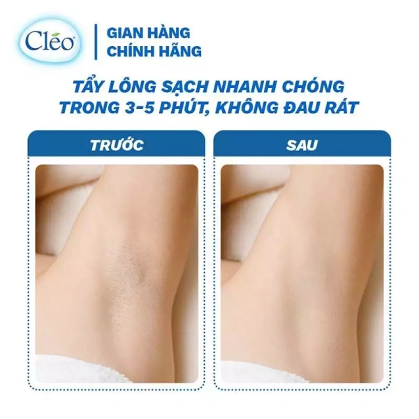Đối chiếu giữa kem tẩy lông, cạo, và waxing (đánh bằng sáp), mỗi phương pháp có ưu nhược điểm riêng về ảnh hưởng đến da. (Ảnh 3)