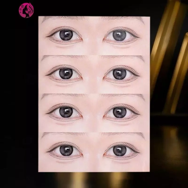 Chỉ vài buổi tập với dụng cụ tập luyện lông mi thường không đủ; kết quả bền vững xuất hiện sau một tháng kiên nhẫn - Ảnh 1 Chỉ vài buổi tập với dụng cụ tập luyện lông mi thường không đủ; kết quả bền vững xuất hiện sau một tháng kiên nhẫn - Ảnh 1