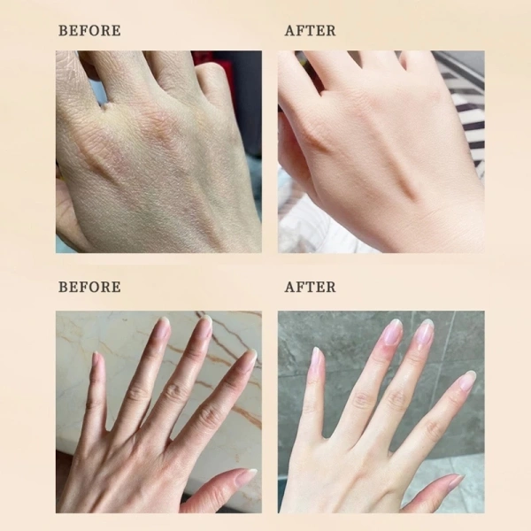 Lớp sừng (stratum corneum) là lớp bề mặt bảo vệ da, chứa các tế bào chết và chất béo giúp duy trì độ ẩm. (Ảnh 2)