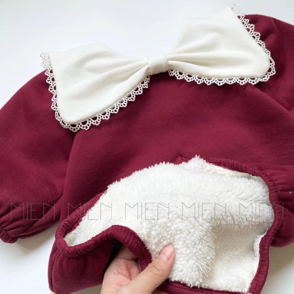 Đêm lạnh bé ủ ngủ ấm trong bodysuit nỉ lót lông dày, sáng dậy da lại đỏ ửng vì nhiệt độ quá cao - Ảnh 3 Đêm lạnh bé ủ ngủ ấm trong bodysuit nỉ lót lông dày, sáng dậy da lại đỏ ửng vì nhiệt độ quá cao - Ảnh 3