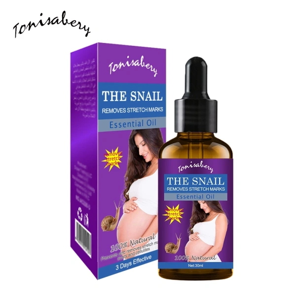 Rạn da, còn được gọi là “stretch marks”, là các đường nứt nho nhỏ trên lớp da trung bình khi mô collagen và elastin bị kéo dãn quá mức. (Ảnh 2) Rạn da, còn được gọi là “stretch marks”, là các đường nứt nho nhỏ trên lớp da trung bình khi mô collagen và elastin bị kéo dãn quá mức. (Ảnh 2)