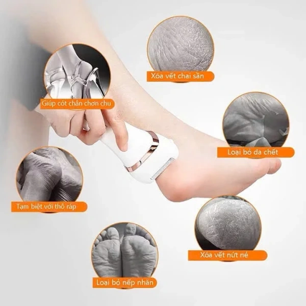Những kết quả trên cho thấy máy không thể “phép màu” loại bỏ hoàn toàn nứt gò trong thời gian ngắn, nhưng góp phần làm giảm đáng kể cảm giác khó chịu và tạo nền tảng cho việc chăm sóc da chân tiếp tục. (Ảnh 4)
