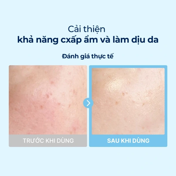 Để biến “độ ẩm tức thì” thành “độ ẩm kéo dài”, bạn có thể áp dụng các mẹo sau đây trong quy trình chăm sóc da hàng ngày. (Ảnh 3)