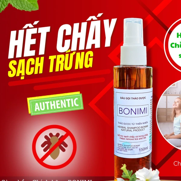 Sau một tuần áp dụng phương pháp diệt chấy, tại sao trứng chấy vẫn còn xuất hiện? - Ảnh 1