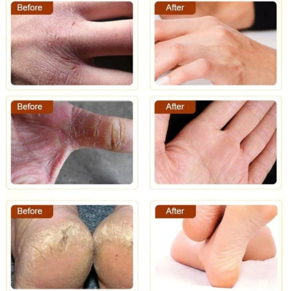 Thời tiết lạnh không chỉ giảm độ ẩm không khí mà còn làm giảm độ ẩm nội tại của da. (Ảnh 3)