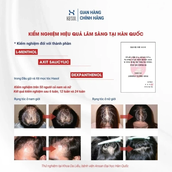 Tại sao sau khi thường xuyên xịt kích mọc tóc, da đầu lại cảm thấy nhờn trong khi tóc vẫn chưa dày hơn? - Ảnh 5