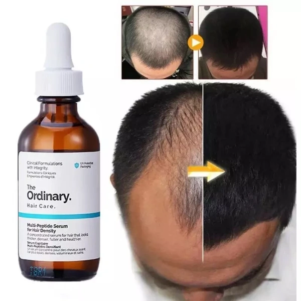 Q: Có nên dùng tinh chất polypeptide cùng với các loại thuốc chữa rụng tóc không? (Ảnh 5)