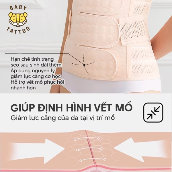 Đai nịt chỉ là một công cụ hỗ trợ, kết hợp với các thói quen lành mạnh sẽ mang lại kết quả tốt hơn. (Ảnh 5) Đai nịt chỉ là một công cụ hỗ trợ, kết hợp với các thói quen lành mạnh sẽ mang lại kết quả tốt hơn. (Ảnh 5)