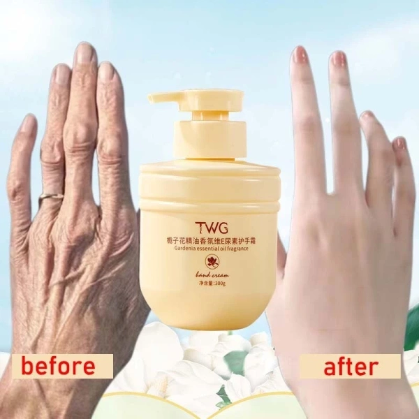 Da tay ngừng nứt nẻ sau một tháng chăm sóc với kem dưỡng ẩm và làm trắng nhẹ nhàng