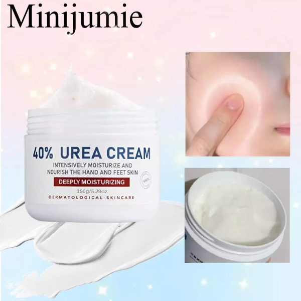 Sự khác biệt khi dùng kem tay chứa urê để ngăn ngừa nứt nẻ so với chỉ dùng kem thông thường