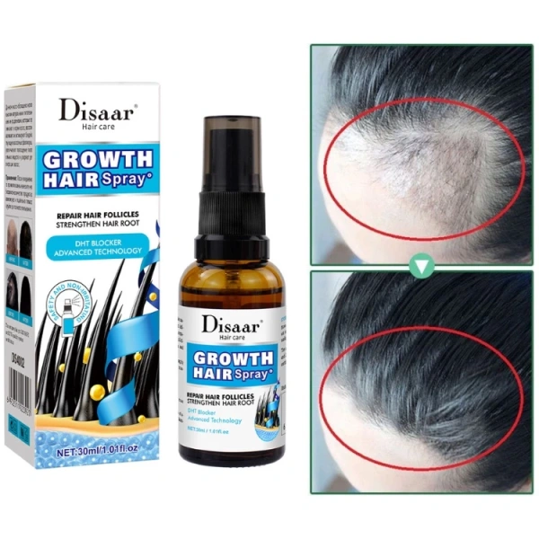 Từ kỳ vọng bám rối đến mái tóc dày hơn chỉ sau một tháng dùng tinh chất thảo dược kích thích mọc tóc