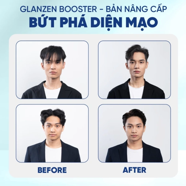 Q1: Xịt tạo phồng có làm tóc hư tổn không? (Ảnh 5) Q1: Xịt tạo phồng có làm tóc hư tổn không? (Ảnh 5)