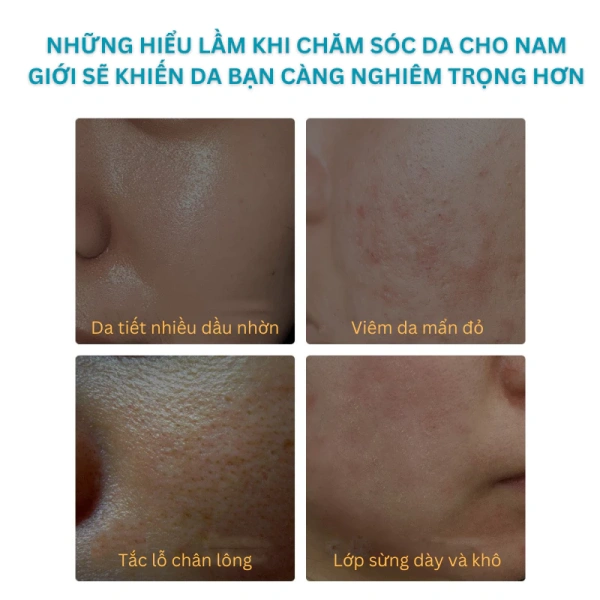 Nhớ rằng, sức khỏe da không chỉ dựa vào một sản phẩm duy nhất mà là sự kết hợp của chế độ sinh hoạt, dinh dưỡng và chăm sóc đúng cách. (Ảnh 5) Nhớ rằng, sức khỏe da không chỉ dựa vào một sản phẩm duy nhất mà là sự kết hợp của chế độ sinh hoạt, dinh dưỡng và chăm sóc đúng cách. (Ảnh 5)