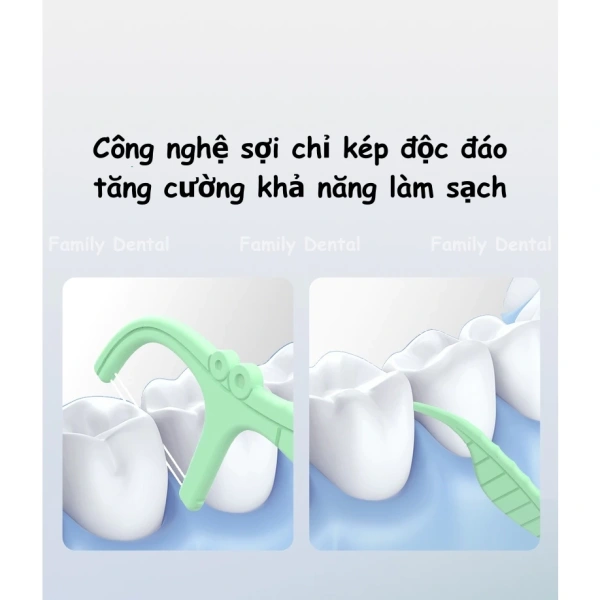 Một trong những yếu tố chính khiến người dùng gặp khó khăn là độ đàn hồi quá mức ở phần cổ thanh. (Ảnh 2)