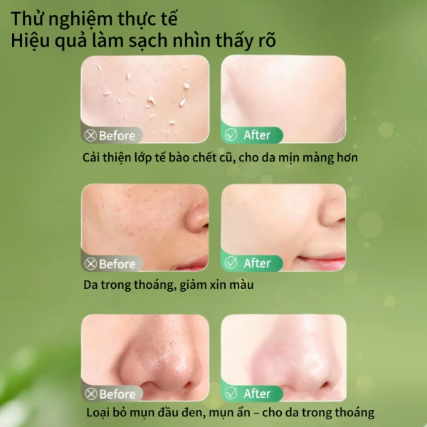 Da sáng hơn sau tuần đầu dùng gel tẩy da chết trà xanh, nhưng dầu thừa vẫn bùng nổ vào buổi tối - Ảnh 3 Da sáng hơn sau tuần đầu dùng gel tẩy da chết trà xanh, nhưng dầu thừa vẫn bùng nổ vào buổi tối - Ảnh 3