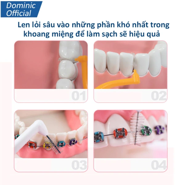 Độ rộng của bàn chải kẽ răng cho niềng ảnh hưởng tới cảm giác sạch sẽ suốt cả ngày – điều mà ít người để ý - Ảnh 2 Độ rộng của bàn chải kẽ răng cho niềng ảnh hưởng tới cảm giác sạch sẽ suốt cả ngày – điều mà ít người để ý - Ảnh 2