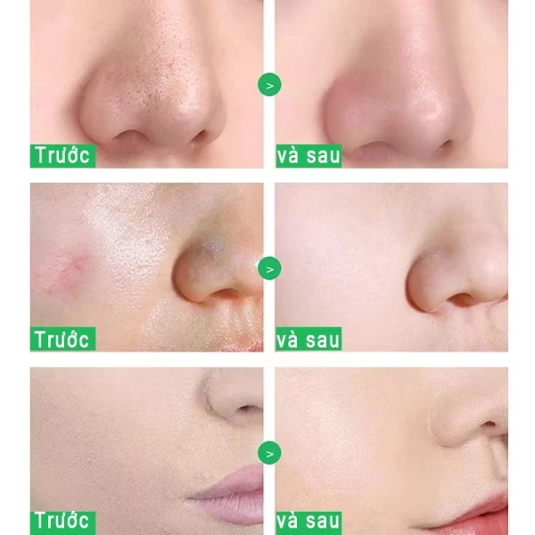 Gel tẩy tế bào chết thường chứa các thành phần hoạt tính mạnh như axit AHA, enzym hoặc hạt tẩy mịn để phá vỡ liên kết giữa các tế bào chết. (Ảnh 2)