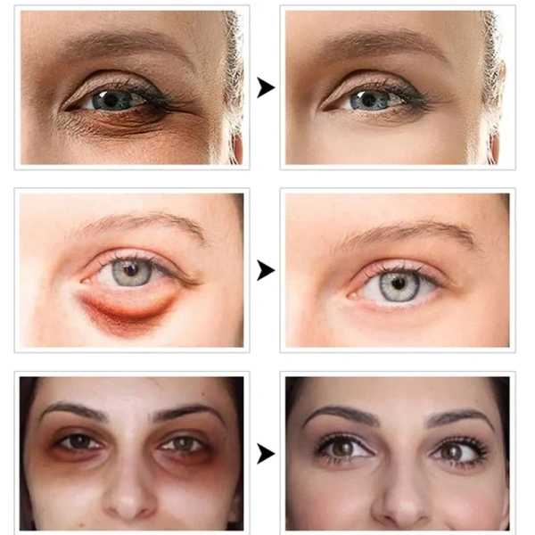 Collagen là thành phần protein quan trọng cấu thành nên cấu trúc da. (Ảnh 3) Collagen là thành phần protein quan trọng cấu thành nên cấu trúc da. (Ảnh 3)