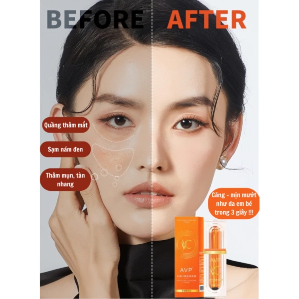 Đối với làn da dầu, việc chọn kem dạng “gel nhẹ” hoặc “kem lỏng” sẽ tránh cảm giác bám dính, đồng thời giúp da thoáng khí, giảm nguy cơ bít tắc lỗ chân lông. (Ảnh 3)