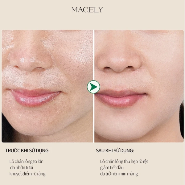 Macely đã xây dựng được vị thế nhờ việc “kết hợp ba tác dụng trong một lọ” – cách ly, làm sáng và kiểm soát dầu. (Ảnh 4) Macely đã xây dựng được vị thế nhờ việc “kết hợp ba tác dụng trong một lọ” – cách ly, làm sáng và kiểm soát dầu. (Ảnh 4)