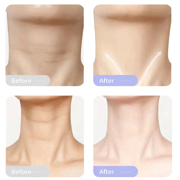 Chọn SPF từ 30 trở lên, chống tia UVA và UVB. (Ảnh 4)