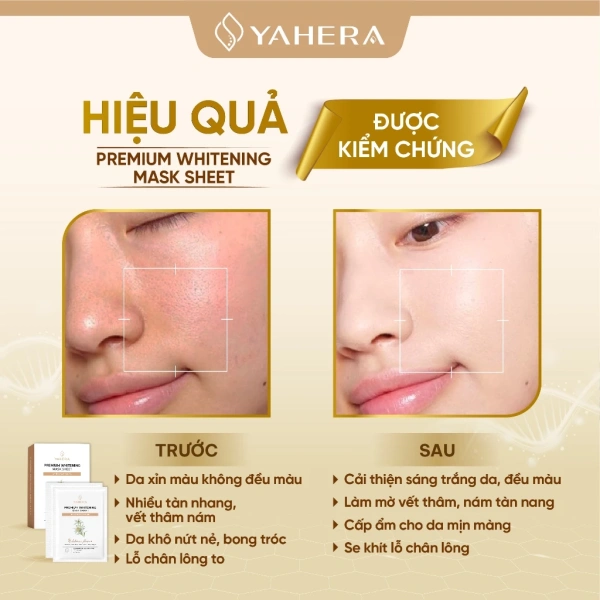Mặt nạ thạch nước dừa, chẳng hạn như Hộp 10 mặt nạ dưỡng trắng da thạch nước dừa tươi YAHERA Premium Whitening Mask Sheet, có thể được xem như một bước “bổ sung độ ẩm sâu” trong chuỗi chăm sóc da. (Ảnh 5)