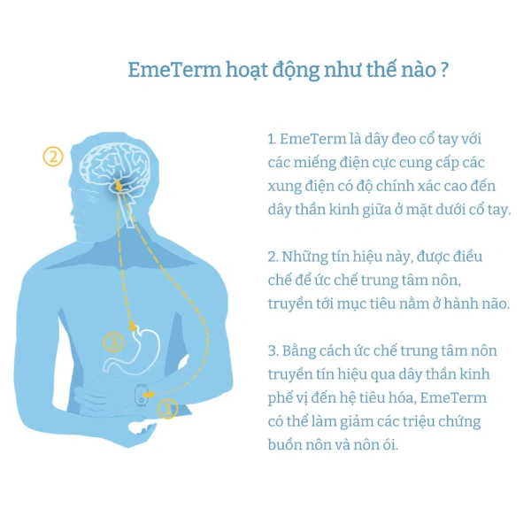 Mong giải pháp không thuốc, thực tế lại là cảm giác an tâm bất ngờ khi đeo vòng đeo tay chống buồn nôn - Ảnh 3