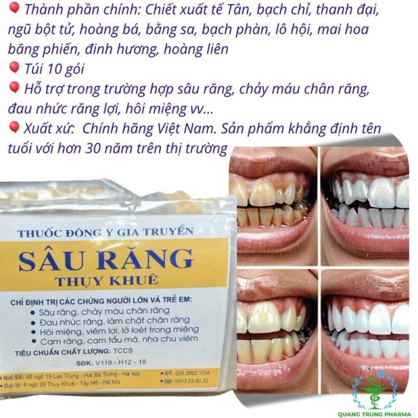 Hôi miệng nhẹ, đặc biệt khi xuất hiện sau bữa ăn mà không phải do tỏi, hành hay cà phê, thường liên quan đến vi khuẩn sinh trưởng trên bề mặt răng và nướu. (Ảnh 2)
