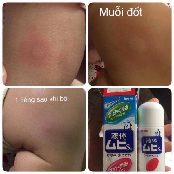 Thị trường hiện nay có nhiều thương hiệu Nhật và Hàn nổi tiếng về kem xua muỗi dạng lăn. (Ảnh 3) Thị trường hiện nay có nhiều thương hiệu Nhật và Hàn nổi tiếng về kem xua muỗi dạng lăn. (Ảnh 3)