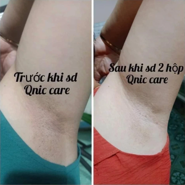 Sau khi dùng kem giảm thâm nách, mùi hôi giảm dần và vùng da sáng hơn – điều mà nhiều người chưa ngờ. - Ảnh 5