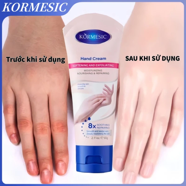 Độ ẩm tay cải thiện đáng kể sau một tháng dùng kem dưỡng da tay, nhưng hiệu quả làm trắng lại không như mong đợi